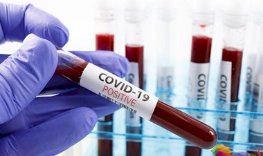 Sri Lanka detects cluster of 296 COVID-19 cases on Friday