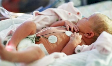 Sri Lankan doctors seek urgent medical supplies to save babies